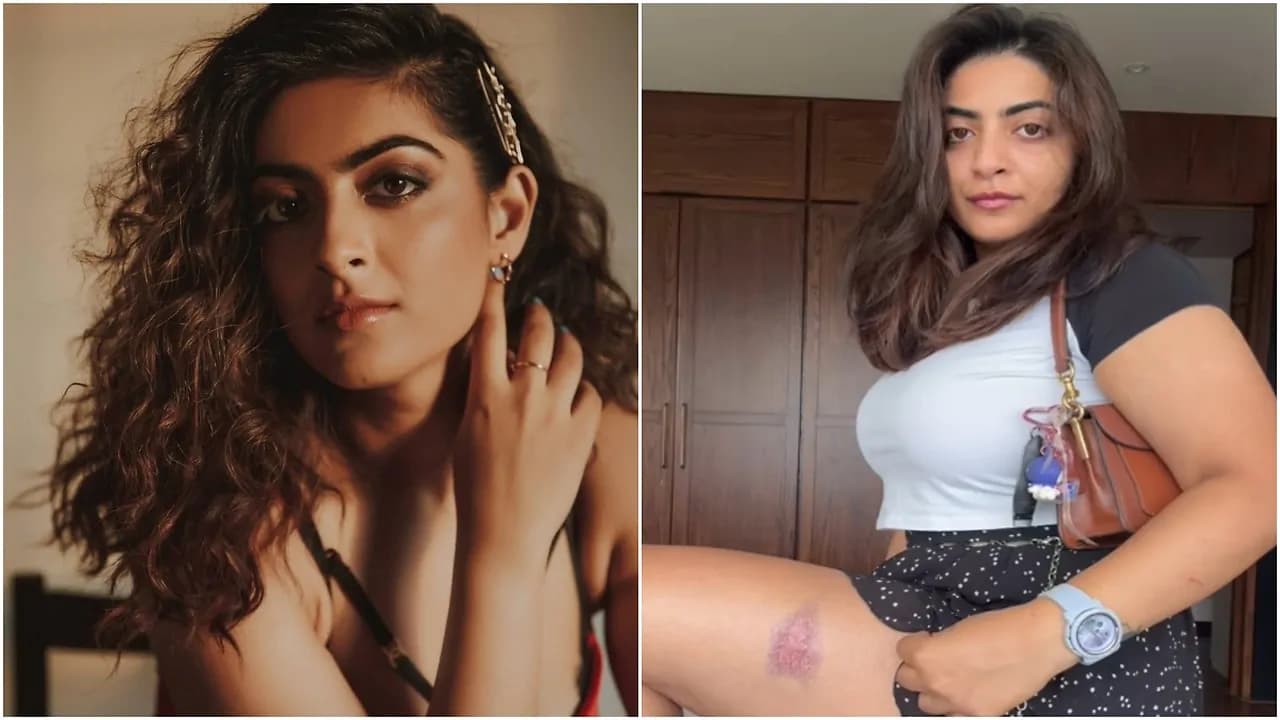 ఆమీర్ ఖాన్ బంధువుకు గాయాలు.. పోలీసుల అదుపులో ఆమీర్ ఖాన్ బంధువుకు గాయాలు.. పోలీసుల అదుపులో