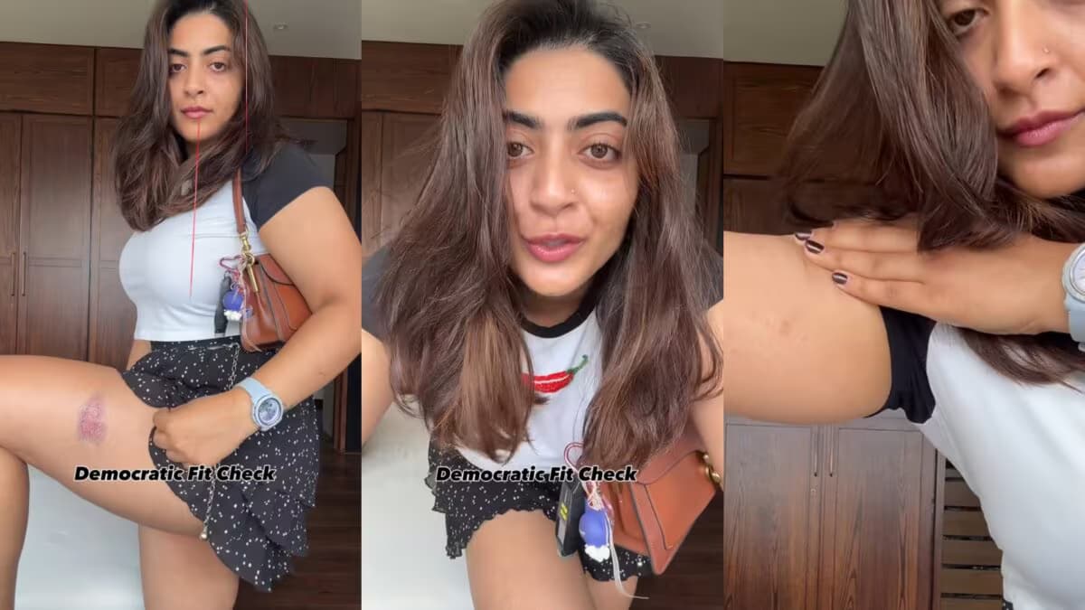 ఆమీర్ ఖాన్ మేనకోడలు జైన్ మారీకి గాయాలు.. వీడియోలో చూపించింది ఆమీర్ ఖాన్ మేనకోడలు జైన్ మారీకి గాయాలు.. వీడియోలో చూపించింది